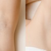 【脇毛処理】自宅で簡単キレイにムダ毛処理するおすすめの方法!