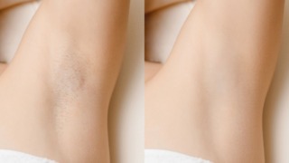 【脇毛処理】自宅で簡単キレイにムダ毛処理するおすすめの方法!