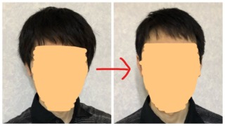 1000円カットに初めて行ったビフォーアフター【40代男性】